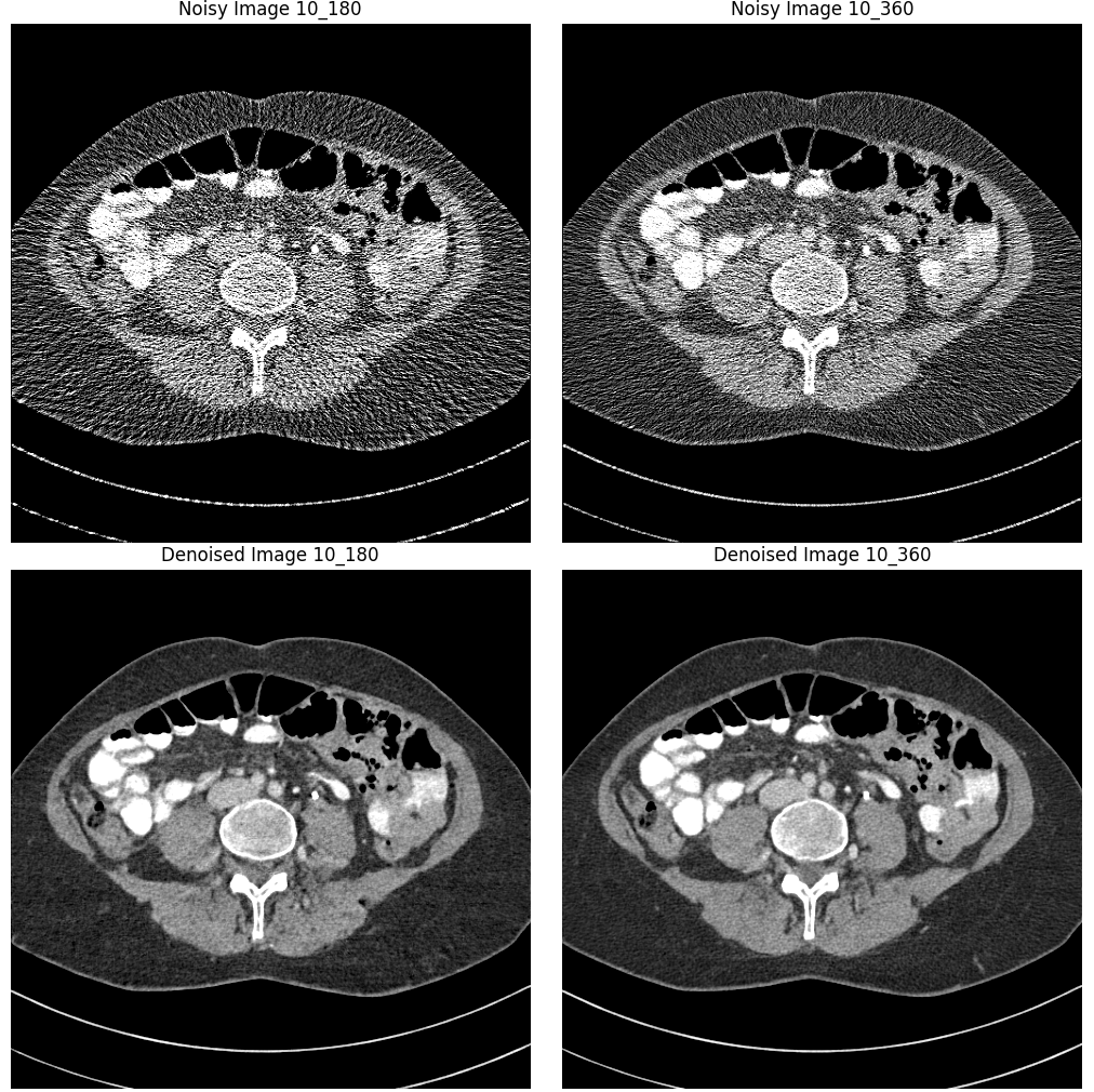CT Image Example